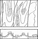 Figure2: Boundaries in defense