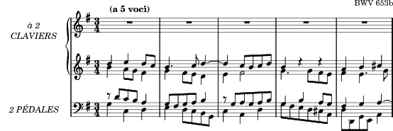 Music preview