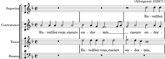 Music preview