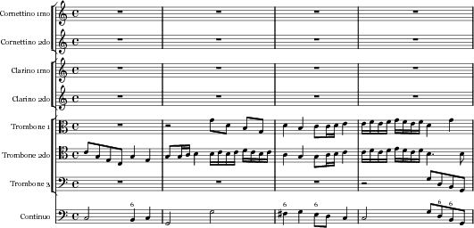 Music preview