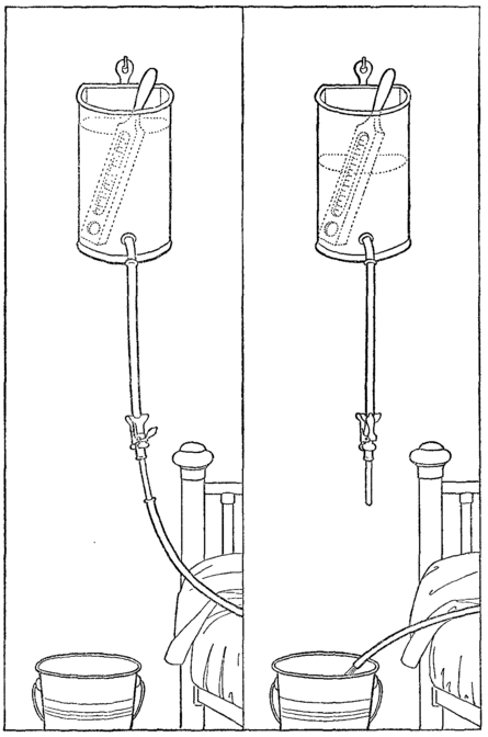 Пытка клизмой. Клизма kisstch Automatic Electric enema Bulb. Принудительное клизмение. Селфбондаж клизма рисунки. High Volume Coloclean enema Part 2.